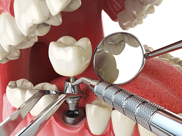 Best Emergency Treatment for Jaw Pain or Injury in Rio Grande, NJ